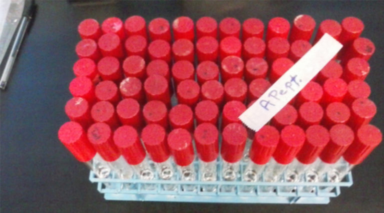 Descubren un método para combatir la bacteria EscherichiaColi O157 H7